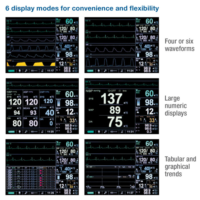 Colin BP-S510 Patient Monitor - Image 5