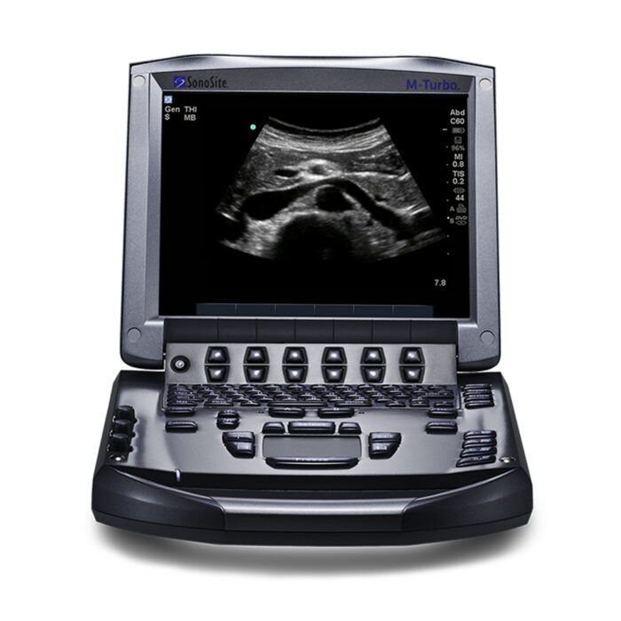 Sonosite M-Turbo Ultrasound System